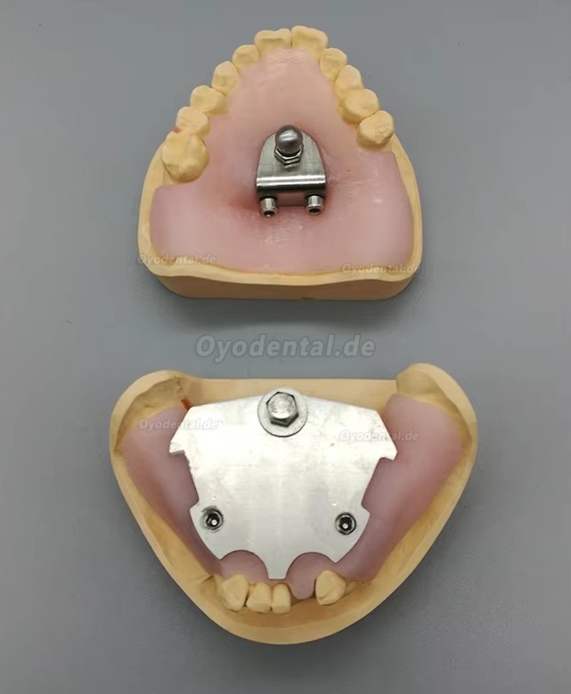 Dental Gothic Arch Tracer Zentrikregistrierer f&uuml;r Zahnlose Patienten Dentallabor